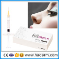 Reyoungel Hyaluronate Acid Dermal Filler Injection for Shaping Perfect Facial Contour